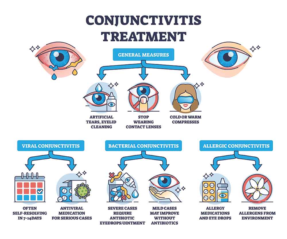 Examining the eye surface for signs of conjunctivitis