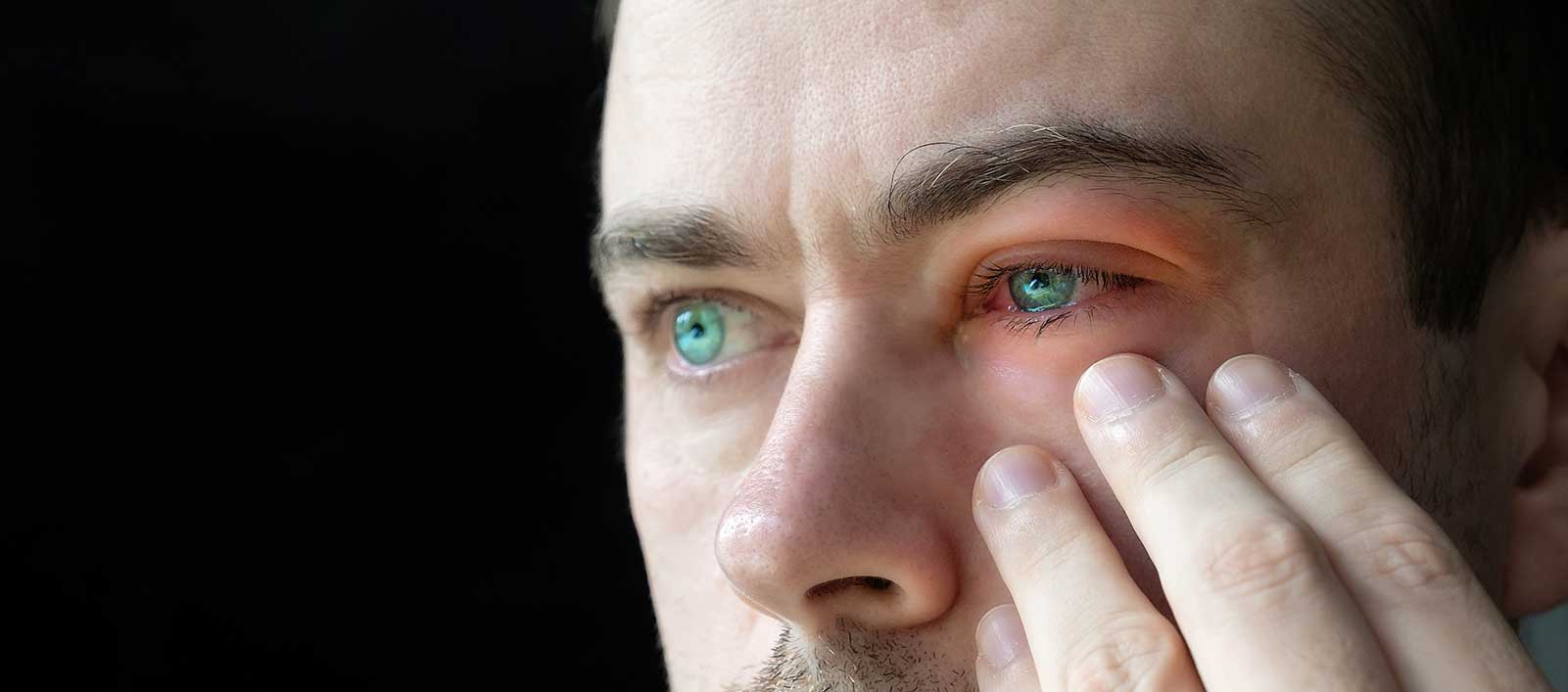 Red eye evaluation and treatment in Yorkville, IL